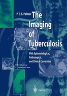 The Imaging of Tuberculosis: With Epidemiological, Pathological and Clinical Correlation