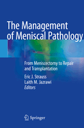 The Management of Meniscal Pathology: From Meniscectomy to Repair and Transplantation