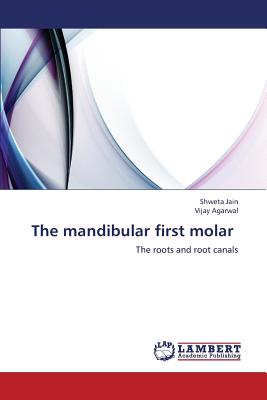 The Mandibular First Molar - Jain Shweta, and Agarwal Vijay