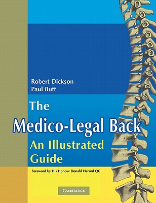 The Medico-Legal Back: An Illustrated Guide - Dickson, Robert A., and Butt, W. Paul