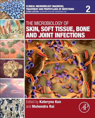 The Microbiology of Skin, Soft Tissue, Bone and Joint Infections - Kon, Kateryna (Editor), and Rai, Mahendra (Editor)