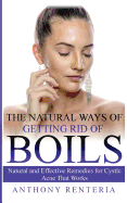 The Natural Ways of Getting Rid of Boils: Natural and Effective Remedies for Cystic Acne That Works