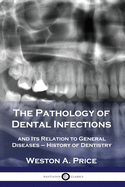 The Pathology of Dental Infections: and Its Relation to General Diseases - History of Dentistry