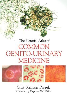 The Pictorial Atlas of Common Genito-Urinary Medicine - Pareek, Shiva