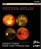 The Retina Atlas CD-ROM - Guyer, David R, Dr., MD, and Yannuzzi, Lawrence A, MD, and Green, W Richard, MD