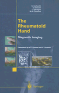 The Rheumatoid Hand: Diagnostic Imaging