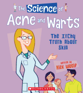The Science of Acne and Warts: The Itchy Truth about Skin (the Science of the Body)