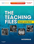The Teaching Files: Head and Neck Imaging: Expert Consult - Online and Print