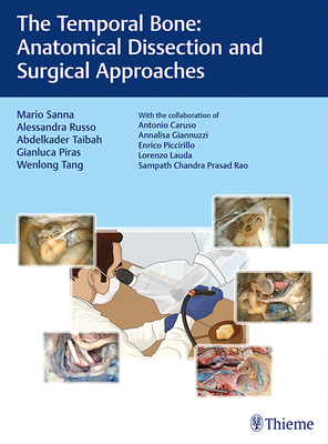 The Temporal Bone: Anatomical Dissection and Surgical Approaches - Sanna, Mario, and Russo, Alessandra, and Taibah, Abdelkader