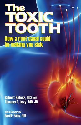 The Toxic Tooth: How a root canal could be making you sick - Kulacz, Robert, Dds, and Levy, Jd, MD