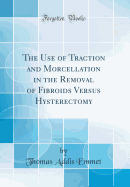 The Use of Traction and Morcellation in the Removal of Fibroids Versus Hysterectomy (Classic Reprint)