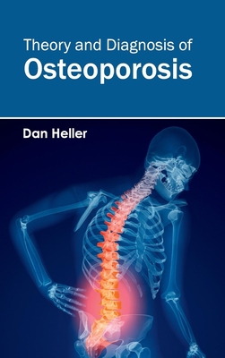 Theory and Diagnosis of Osteoporosis - Heller, Dan (Editor)