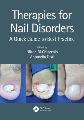 Therapies for Nail Disorders: A Quick Guide to Best Practice - Di Chiacchio, Nilton (Editor), and Tosti, Antonella (Editor)