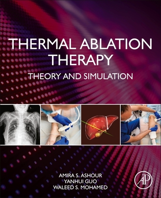 Thermal Ablation Therapy: Theory and Simulation - Ashour, Amira S, and Guo, Yanhui, and Mohamed, Waleed S