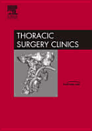 Thoracic Anesthesia and Pain Management, an Issue of Thoracic Surgery Clinics: Volume 15-1 - Ferguson, Mark K, MD, and Klafta, Jerome, MD