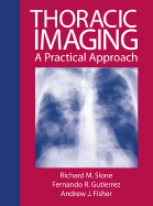 Thoracic Imaging: A Practical Approach