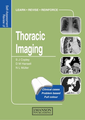 Thoracic Imaging: Self-Assessment Colour Review - Copley, Sue, and Hansell, David M, and Muller, Nestor L, MD, PhD