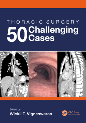 Thoracic Surgery: 50 Challenging Cases - Vigneswaran, Wickii (Editor)