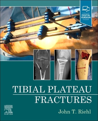 Tibial Plateau Fractures - Riehl, John, MD