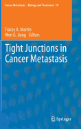 Tight Junctions in Cancer Metastasis