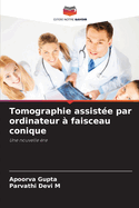 Tomographie assist?e par ordinateur ? faisceau conique