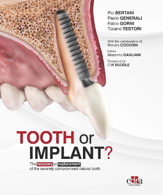 Tooth or Implant - Bertani, Pio (Screenwriter), and Generali, Paolo, and Gorni, Fabio