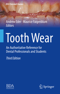 Tooth Wear: An Authoritative Reference for Dental Professionals and Students