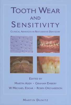 Tooth Wear and Sensitivity - Addy, Martin, and Embery, Graham, and Edgar, Michael
