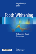 Tooth Whitening: An Evidence-Based Perspective