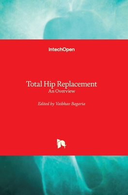 Total Hip Replacement: An Overview - Bagaria, Vaibhav (Editor)