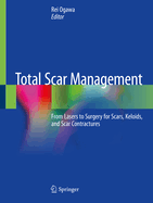 Total Scar Management: From Lasers to Surgery for Scars, Keloids, and Scar Contractures