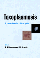 Toxoplasmosis