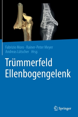 Trmmerfeld Ellenbogengelenk - Moro, Fabrizio (Editor), and Meyer, Rainer-Peter (Editor), and Ltscher, Andreas (Editor)