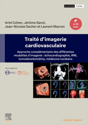 Trait? d'Imagerie Cardiovasculaire: Approche Compl?mentaire Des Diff?rentes Modalit?s d'Imagerie: ?chocardiographie, Irm, Tomodensitom?trie, M?decine Nucl?aire - Garot, J?r?me, and Dacher, Jean-Nicolas, and Cohen, Ariel