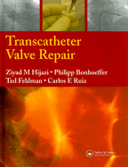 Transcatheter Valve Repair