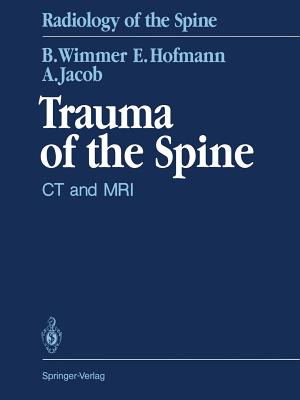 Trauma of the Spine: CT and MRI - Wimmer, Berthold, and Wenz, W (Foreword by), and Hofmann, Erich