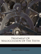 Treatment of Malocculsion of the Teeth