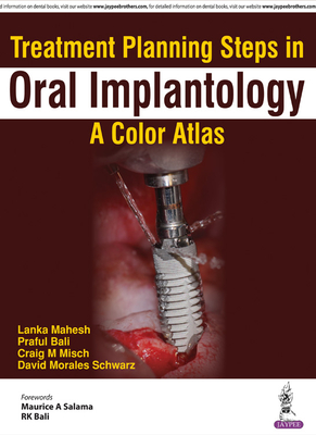 Treatment Planning Steps in Oral Implantology: A Color Atlas - Mahesh, Lanka, and Bali, Praful, and Misch, Craig M