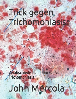 Trick gegen Trichomoniasis: Verabschiede dich nat?rlich von Trichomoniasis - Mercola, John
