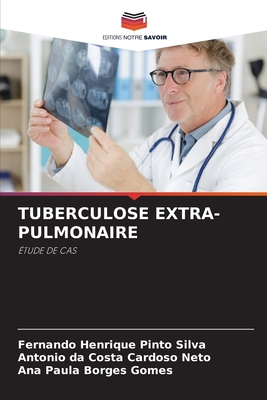 Tuberculose Extra-Pulmonaire - Henrique Pinto Silva, Fernando, and Da Costa Cardoso Neto, Antonio, and Borges Gomes, Ana Paula