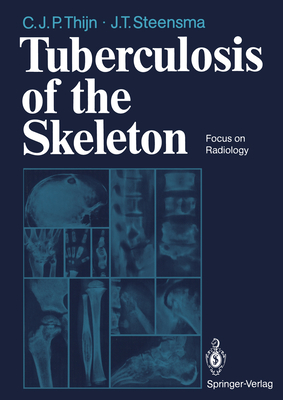 Tuberculosis of the Skeleton: Focus on Radiology - Thijn, Cornelis J P, and Theros, E G (Foreword by), and Steensma, Jieldouw T