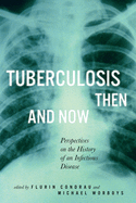 Tuberculosis Then and Now: Perspectives on the History of an Infectious Disease Volume 36