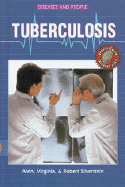 Tuberculosis