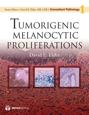 Tumorigenic Melanocytic Proliferations - Elder, David, MB, Chb (Editor)