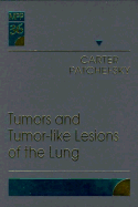 Tumors and Tumor-Like Lesions of the Lung: Volume 36 in the Major Problems in Pathology Series Volume 36 - Carter, Darryl, and Patchefsky, Arthur S, MD