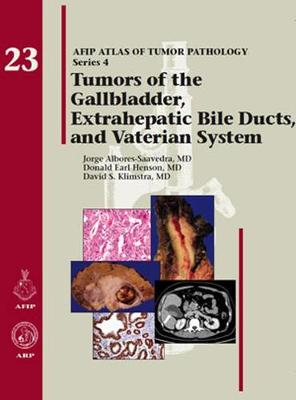 Tumors of the Gallbladder, Extrahepatic Bile Ducts, and Vaterian System - Albores-Saavedra, Jorge, and Henson, Donald Earl, and Klimstra, David S.