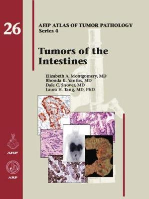 Tumors of the Intestines - Montgomery, Elizabeth A., and Yantiss, Rhonda K., and Snover, Dale C.