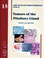 Tumors of the Pituitary Gland: AFIP Atlas of Tumor Pathology, Series 4