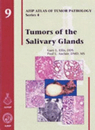 Tumors of the Salivary Glands: Series 4