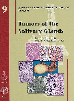 Tumors of the Salivary Glands - Ellis, Gary L, Dds, and Auclair, Paul L